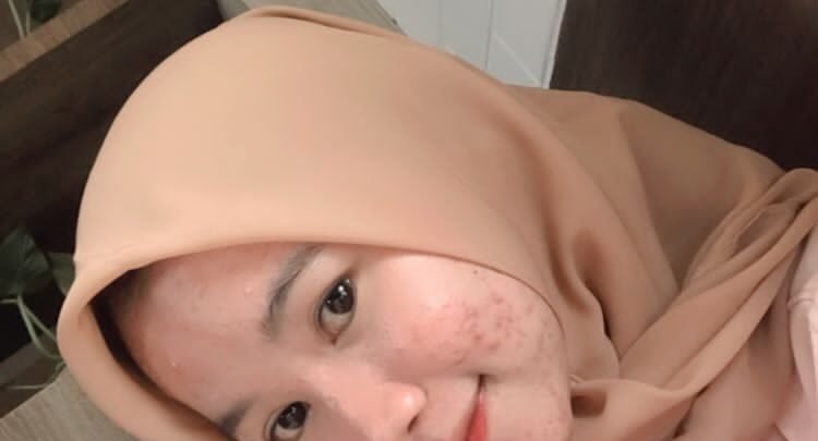 Norawati